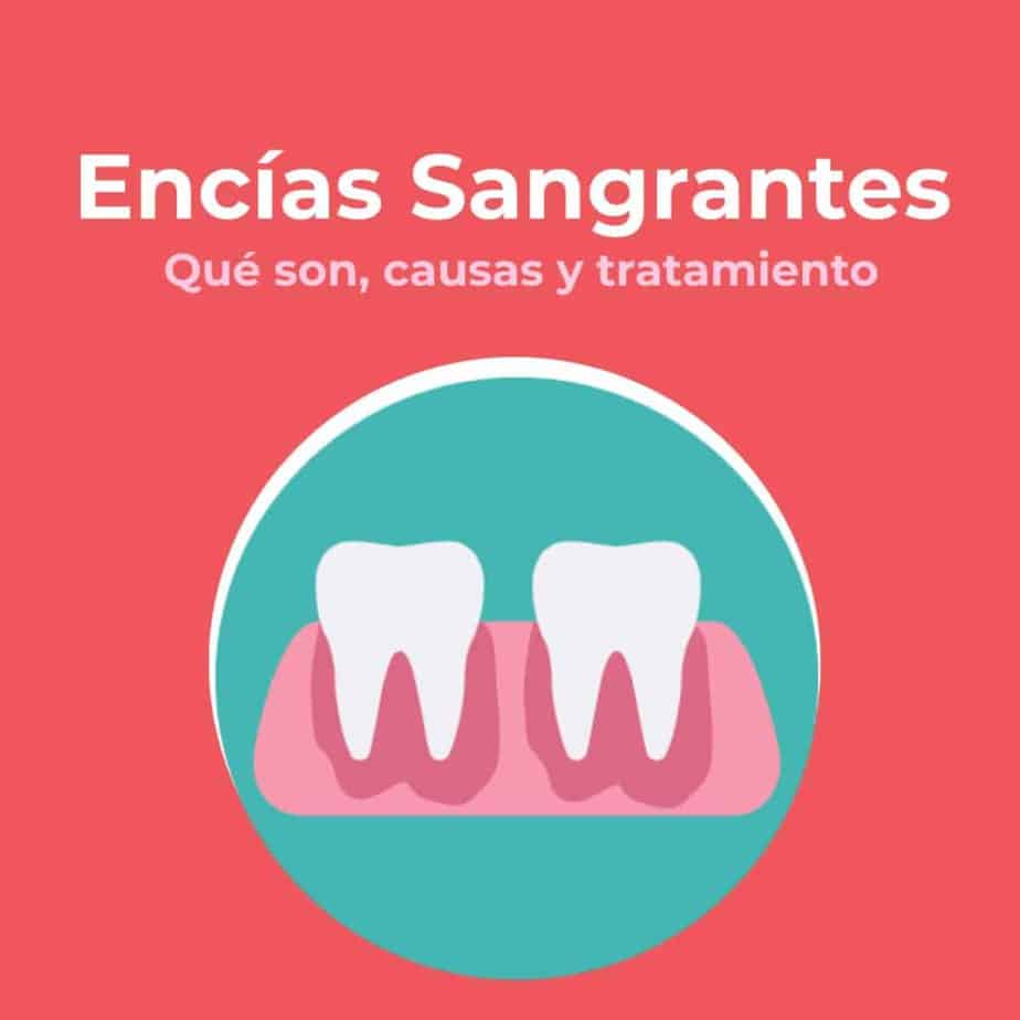 Encías Sangrantes | Clínica Dental en Valencia Artdenta