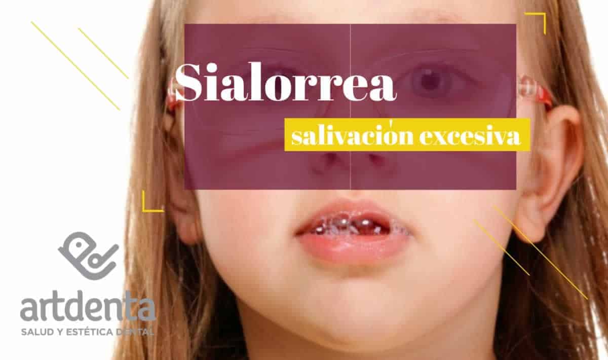 Banner Sialorrea | Clínica Dental Artdenta