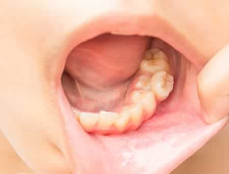 Maloclusión Dental | Clínica Dental Artdenta