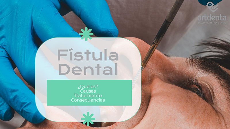 Banner Fístula Dental | Clínica Dental Artdenta Valencia