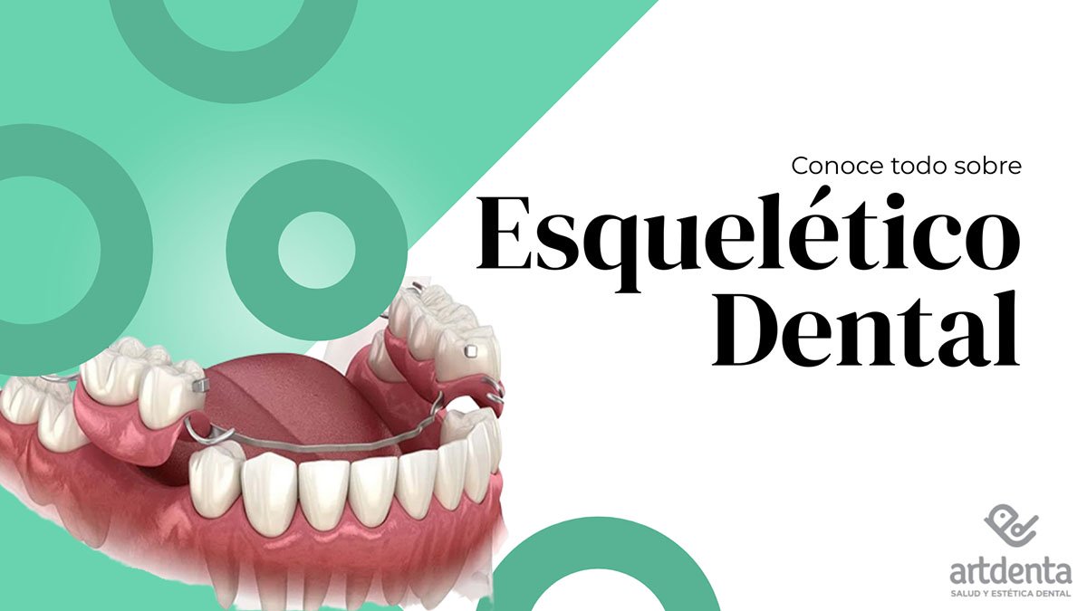 Banner Esquelético Dental | Clínica Dental Artdenta Valencia